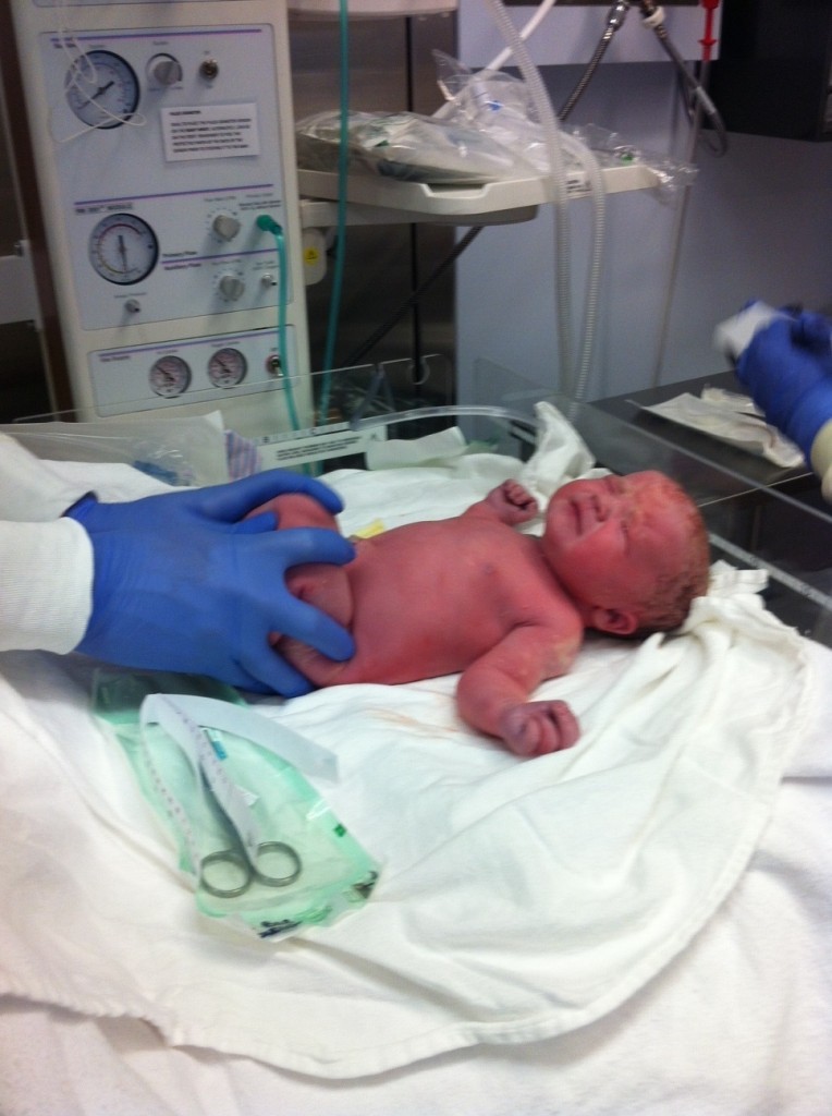 newborn baby born via c section