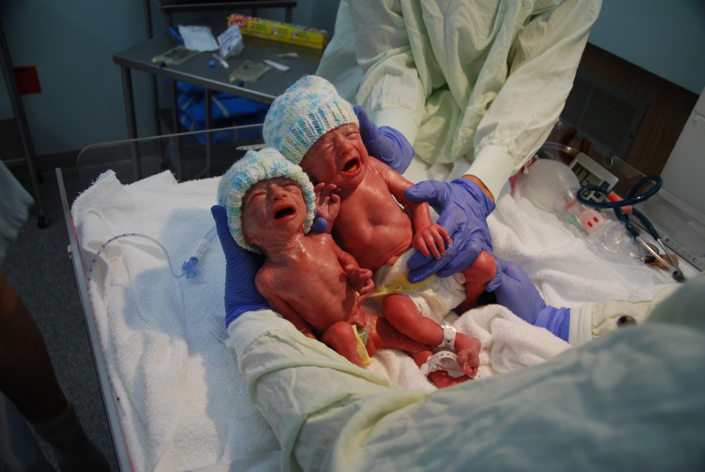 premature birth story twin preemies