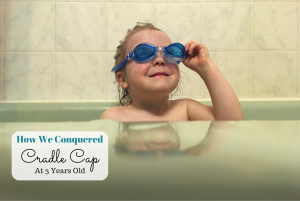 cradle cap #CetaphilBaby